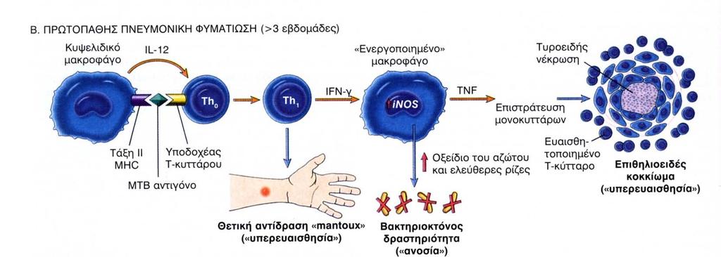 Φυματίωση