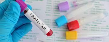 HbA1c, by sex (last episode in 12 months) HbA1c Males Females Total % of total <=7% 227 189 416