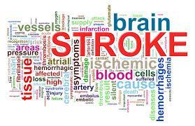 Stroke Stroke Total number of patients % Yes 19