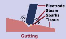 Δράση του κίτρινου (cut) κουμπιού The electrode is not in contact A spark develops that causes vaporization of the tissue.