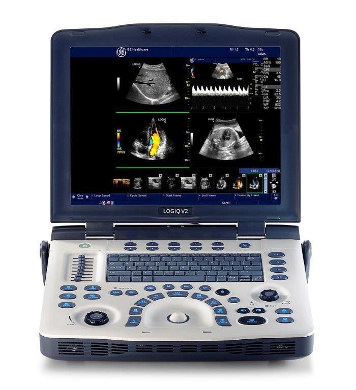 GE Healthcare Σωρού 8-10 151 25 Μαρούσι, Αθήνα T 210 8930 600 F 210 9625 931 ANAΛΥΤΙΚΗ ΤΕΧΝΙΚΗ ΠΕΡΙΓΡΑΦΗ Ψηφιακός Έγχρωμος Φορητός Υπερηχοτομογράφος LOGIQ V2 του Οίκου GE Healthcare Διαγνωστική