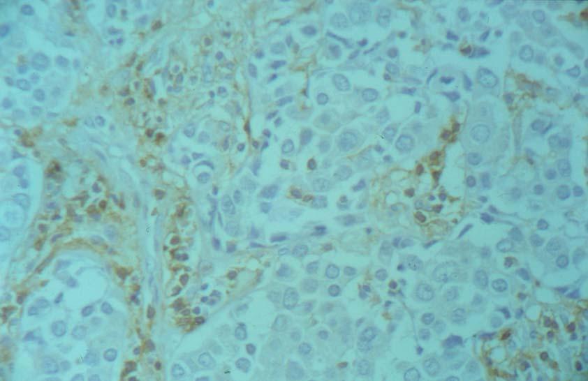 Τ4 λεμφοκύτταρα