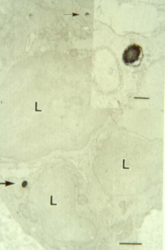 Τ8 λεμφοκύτταρο με