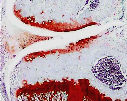 bone area 25 20