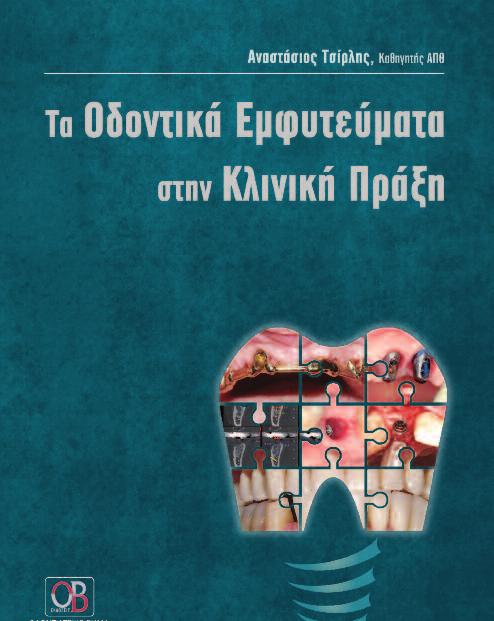 παρουσίαση ρεαλιστικών κλινικών περιστατικών που καλύπτουν, σε µεγάλο βαθµό, τις πλέον πιθανές και κατά περιοχή περιπτώσεις οι οποίες χρήζουν εµφυτευµατικής αποκατάστασης.