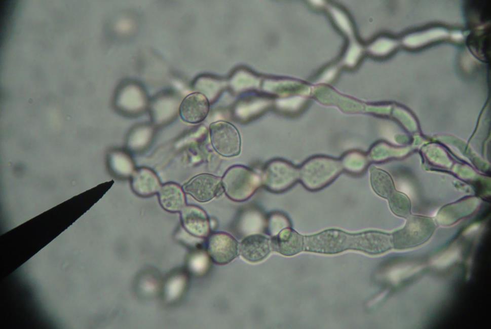Εικ. 62: Κονιδιοφόροι και κονίδια σε αλυσίδες του Monilia laxa από μικροσκόπιο.