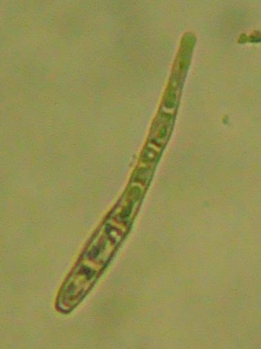 Εικ. 73-75: Κονίδια του Phloeosporella padi. Εικ. 76: Βιολογικός κύκλος του Cylindrosporium padi (Barnett).