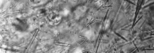 Extracellular