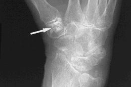 hand Courtesy