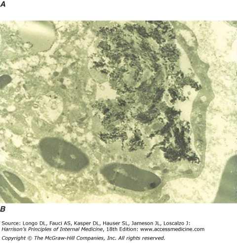 B. An electron micrograph demonstrates dark needle-shaped