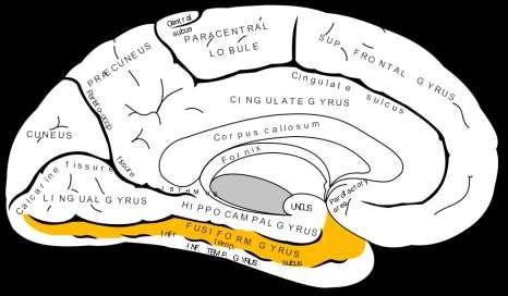 Τελικός εγκέφαλος Ημισφαίρια (Cerebrum)