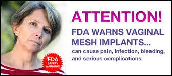 FDA Vs Meshes 2008: FDA informational notification July 2011: 2 nd notification - specialized training - consider risks - advise patients - diagnose and