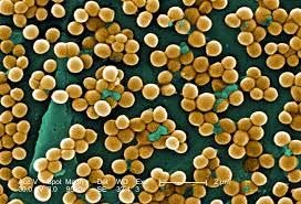 Αντιμικροβιακή θεραπεία MRSA στην κοινότητα (CA-MRSA) Ξεχωριστά στελέχη που διαφέρουν επιδημιολογικά και γενετικά από τα νοσοκομειακά στελέχη - λιγότερους γόνους