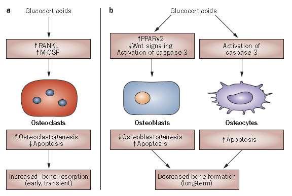 Management of glucocorticoid-induced Osteoporosis.