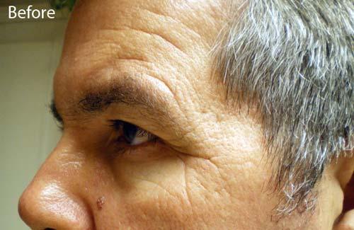 SkinUp Serum «Botox» εύκολα σε 1-3 λεπτά, με ένα serum μόνο και δείξτε αμέσως νεότερη 10 15 χρόνια! για ομορφιά χωρίς νυστέρι, ενέσεις, πόνους και ρίσκο.