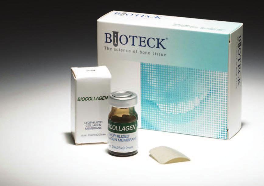 Biocollagen BCG-01 Μεμβράνη κολλαγόνου Collagen Membrane - 6 btl. 25mm 25mm 0.2mm Η Biocollagen είναι μία μεμβράνη ίππιας προέλευσης κατασκευασμένη από κολλαγόνο Αχίλλειου τένοντα.