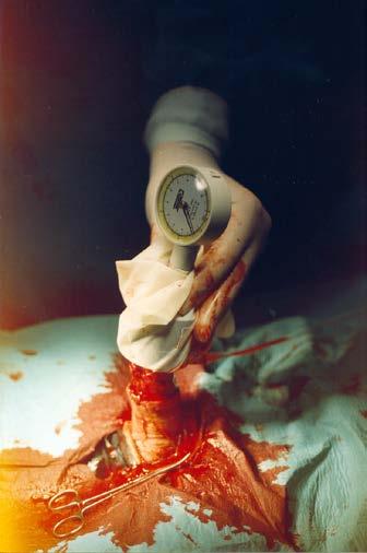 Protective role of the glans penis during