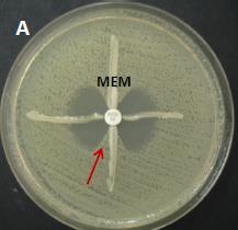 τροποποιημένο Hodge test (MHT), τη δοκιμασία