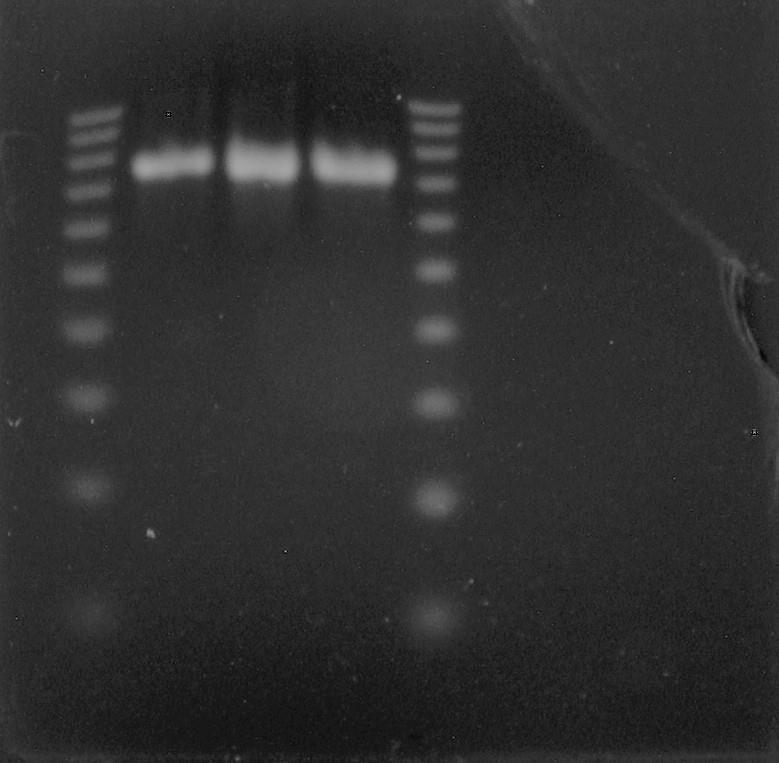 ΜΕΘΟΔΟΙ III Η παρουσία γονιδίων β-λακταμασών επιβεβαιώθηκε με PCR.