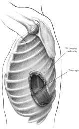 A procedure for the management of