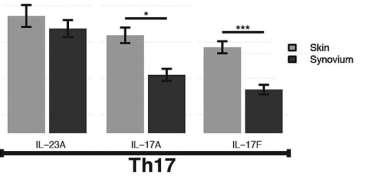 VEGF, TGF-β1 and IL-6 Περισσότερο ενεργοποιημένα στον υμένα