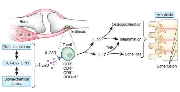 Ψωριασική Αρθρίτιδα Ενθεσίτιδα Enthesis organ synovio-entheseal concept θύλακες, έλυτρα τενόντων, Ινώδη στοιχεία, fat