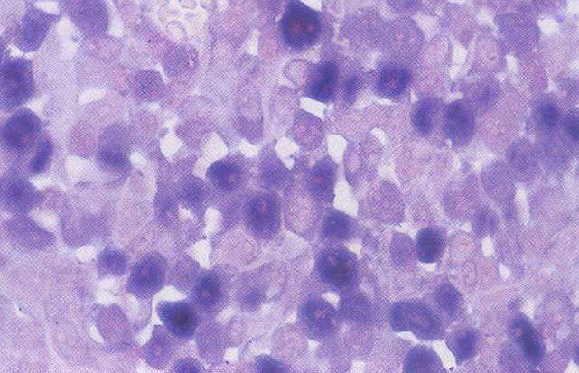 (EBV) CD43 In situ