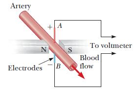 4. Ένας καρδιοχειρούργος παρακολουθεί την παροχή του αίματος σε μια αρτηρία χρησιμοποιώντας ένα ηλεκτρομαγνητικό ροόμετρο.