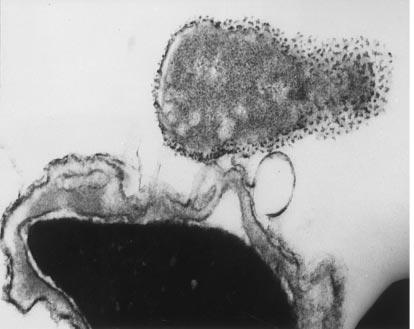 Μικροβιολογικός έλεγχος - Ουρολοιμώξεις