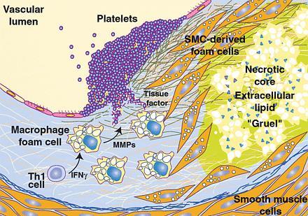 Thrombosis, and collagen