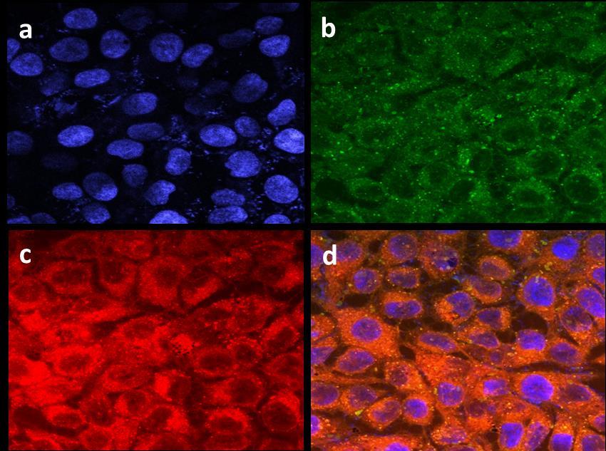 %cytotoxicity 50 45 40 35 30 25 20 15