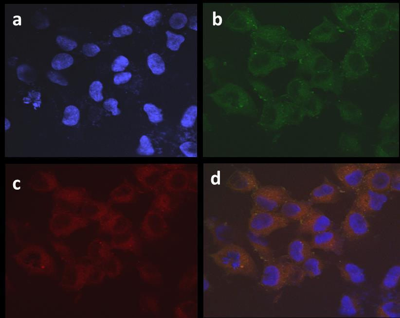 hours PTX-polymersomes 48 hours PTX 48