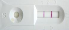 POC-FAECAL CALPROTECTIN (FC TEST) YES