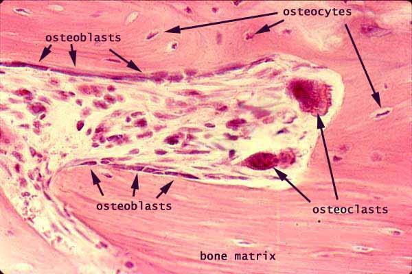 Οστεοκύτταρα Μορφή εξέλιξης των οστεοβλαστών Οι οστεοβλάστες που έχουν εκπληρώσει το έργο τους εγκλωβίζονται μέσα στον οστίτη ιστό, αποκτούν