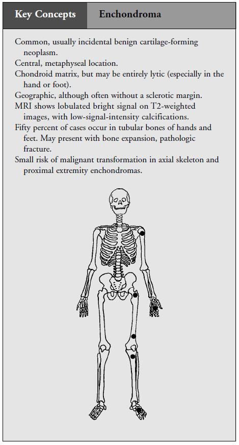 No periostitis Unless pathologic # or malignant transformation 6.