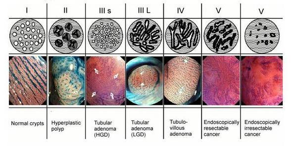 Endoscopy 1993 2002 international