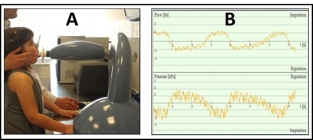 Εικόνα ΙΙ.Α.1. Τεχνική μέτρησης FOT με τη συσκευή i2m σε εξεταζόμενο της μελέτης μας. A: Διαδικασία μέτρησης. Β: Σήματα ροής και πίεσης κατά τη διάρκεια της μέτρησης.