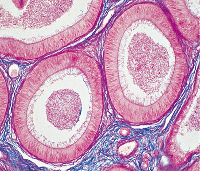 27 ψευδοπολύστιβο επιθήλιο με βασικά κοντά και κύρια μακρά κύτταρα με μικρολάχνες. Η βασική μεμβράνη διαχωρίζει το επιθήλιο από το τοίχωμα. Εικόνα 16. Ιστολογική δομή επιδιδυμίδας (https://viamedici.