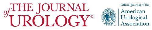 Optimal power settings for Holmium:YAG lithotripsy maximal fragmentation minimal fragment size