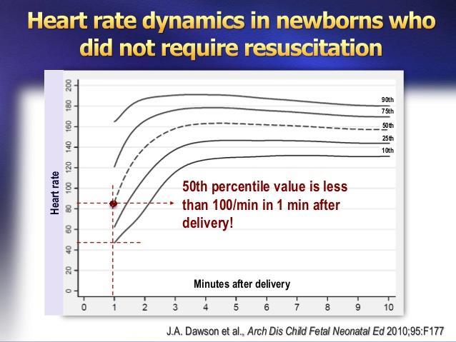 Καρδιακός ρυθμός στα νεογέννητα