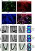 Chemical and biological evaluations of an (111)in-labeled RGD-peptide targeting integrin alpha(v) beta(3) in a preclinical tumor model.