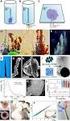 Recent Developments of Self2Propagating Frontal Polymerization