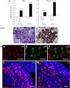 Stage2specific Expression Analysis of Mouse Testis2specific Genes in Spermatogenic Cells. GUO Rui LI Xi2Xia WANG Hui2Zhen. , ; Prm1 Prm2 Tnp1 Tnp2