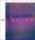 Comparative evaluation of selective culture and PCR for detection of Fusobacterium necrophorum and Fusobacterium nucleatum in throat specimens