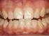 Παθολογία Σκληρών Οδοντικών Ιστών