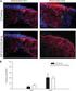 Islet Transplantation without Borders