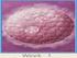 Φυσιολογικά, µε την είσοδο του σπερµατοζωαρίου, το ωάριο υφίσταται µεταβολές (εµπόδιο στην πολυσπερµία), οι οποίες παρεµποδίζουν την περαιτέρω είσοδο