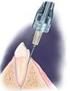 Μελέτη των stent µε µικροσκοπία ατοµικών δυνάµεων AFM