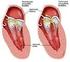 Πνευμονική Υπέρταση στην αριστερή καρδιακή ανεπάρκεια. Νάσος Μαγγίνας, MD FACC, FESC