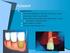 Antimicrobials and antibiotics in periodontology